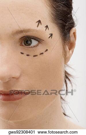 Stock Image - Close-up of a young woman with pre-surgical markings on her face. Fotosearch