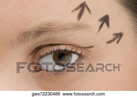 Close-up of a young woman with pre-surgical markings on her face View Large Photo Image Stock Photo - Close-up of a young woman with pre-surgical markings on her face. Fotosearch