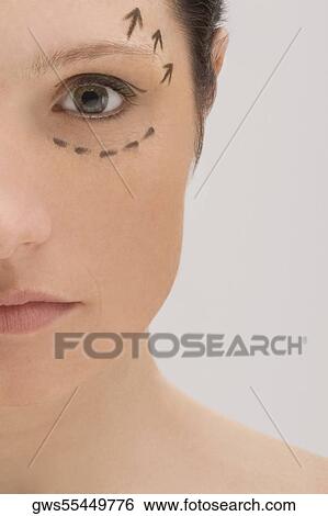 Close-up of a young woman with pre-surgical markings on her face View Large Photo Image Stock Photograph - Close-up of a young woman with pre-surgical markings on her face. Fotosearch