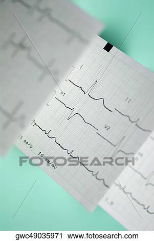 Close-up of an electrocardiogram report View Large Photo Image Stock Image - Close-up of an electrocardiogram report. Fotosearch