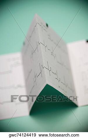Close-up of an electrocardiogram report View Large Photo Image Stock Photo - Close-up of an electrocardiogram report. Fotosearch