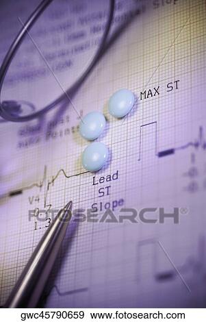 Close-up of an eyeglasses and a pen on a medical report View Large Photo Image Stock Photo - Close-up of an eyeglasses and a pen on a medical report. Fotosearch