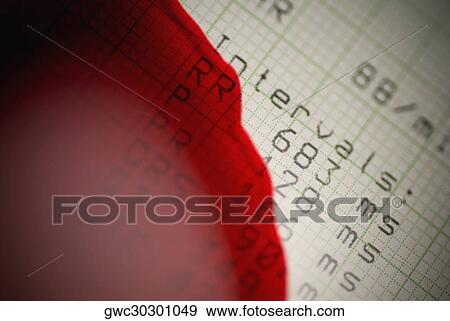 Close-up of blood split on an electrocardiogram report View Large Photo Image Stock Photo - Close-up of blood split on an electrocardiogram report. Fotosearch