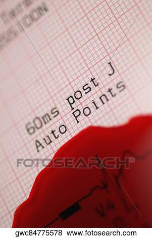 Close-up of blood split on an electrocardiogram report View Large Photo Image Stock Photo - Close-up of blood split on an electrocardiogram report. Fotosearch