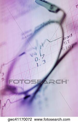 Close-up of eyeglasses on a medical report View Large Photo Image Stock Image - Close-up of eyeglasses on a medical report. Fotosearch