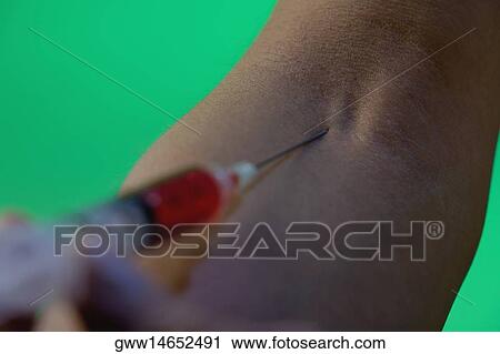 Close-up of a hand injecting a needle into a person's arm View Large Photo Image Stock Image - Close-up of a hand injecting a needle into a person's arm. Fotosearch