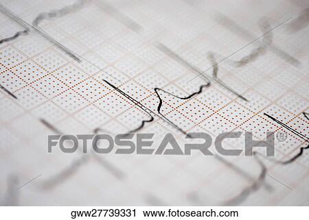 Stock Image - Close-up of an ECG report. Fotosearch
