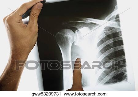 Close-up of a person's hand holding an X-Ray View Large Photo Image Stock Image - Close-up of a person's hand holding an X-Ray. Fotosearch