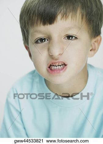 Portrait of a boy clenching his teeth View Large Photo Image Stock Image - Portrait of a boy clenching his teeth. Fotosearch