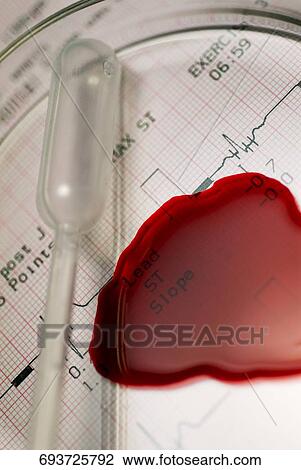 Close-up of a pipette with blood on an electro cardiogram report View Large Photo Image Stock Image - Close-up of a pipette with blood on an electro cardiogram report. Fotosearch
