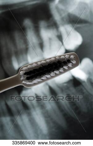 Stock Image - Close-up of a toothbrush on a dental X-Ray. Fotosearch