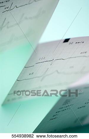Close-up of an electrocardiogram report View Large Photo Image Stock Image - Close-up of an electrocardiogram report. Fotosearch
