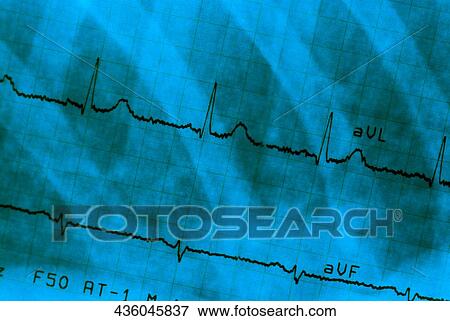 Close-up of an electrocardiogram report View Large Photo Image Stock Photo - Close-up of an electrocardiogram report. Fotosearch