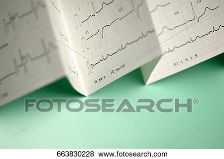 Stock Photo - Close-up of an electrocardiogram report. Fotosearch
