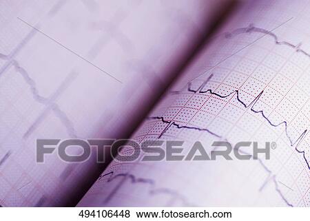 Close-up of an ECG report View Large Photo Image Stock Photo - Close-up of an ECG report. Fotosearch