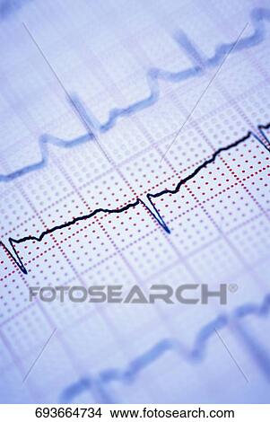 Picture - Close-up of an electro cardiogram report. Fotosearch