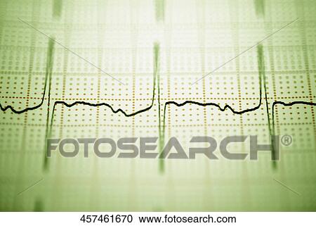 Close-up of an electro cardiogram report View Large Photo Image Stock Image - Close-up of an electro cardiogram report. Fotosearch
