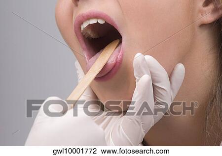 医者 検査 A 女の子 口 で A 舌圧子 ストックイメージ Gwl Fotosearch