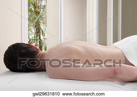 Acupuncture needles on a person's back View Large Photo Image Stock Image - Acupuncture needles on a person's back. Fotosearch