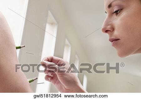 Acupuncturist applying needles and herbal cigars on a person's arm View Large Photo Image Picture - Acupuncturist applying needles and herbal cigars on a person's arm. Fotosearch