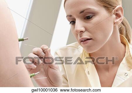 Acupuncturist applying needles and herbal cigars on a person's arm View Large Photo Image Stock Photograph - Acupuncturist applying needles and herbal cigars on a person's arm. Fotosearch
