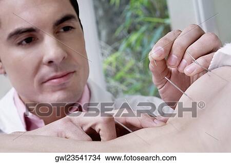 Acupuncturist applying needles on a person's back View Large Photo Image Picture - Acupuncturist applying needles on a person's back. Fotosearch