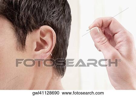 Acupuncturist applying needles on a man's ear View Large Photo Image Stock Image - Acupuncturist applying needles on a man's ear. Fotosearch