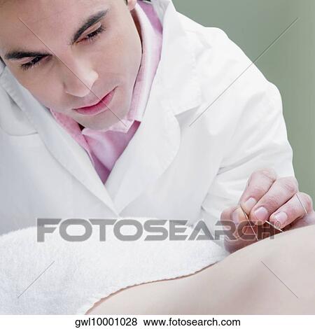 Stock Photo - Acupuncturist applying needles on a person's back. Fotosearch