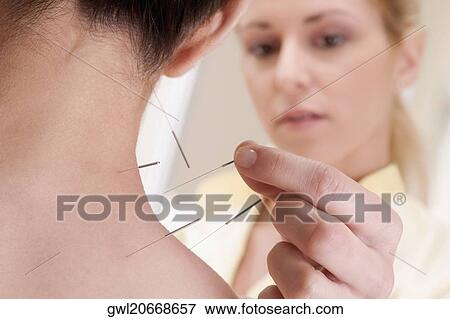 Acupuncturist applying needles on a person's back View Large Photo Image Stock Photo - Acupuncturist applying needles on a person's back. Fotosearch