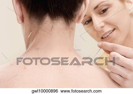 Acupuncturist applying needles on a woman's back View Large Photo Image Stock Photograph - Acupuncturist applying needles on a woman's back. Fotosearch