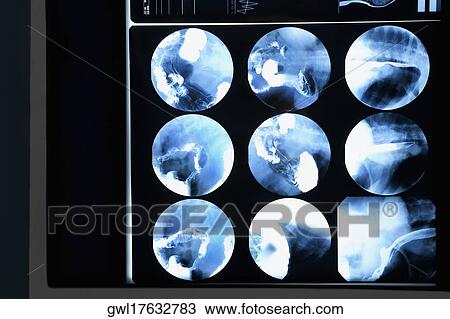 Close-up of MRI scan report View Large Photo Image Stock Image - Close-up of MRI scan report. Fotosearch
