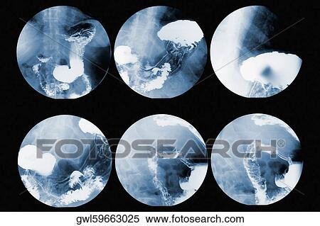Close-up of MRI scan report View Large Photo Image Stock Photography - Close-up of MRI scan report. Fotosearch