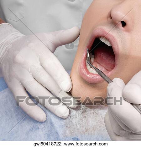 Stock Image - Dentist examining a man's teeth. Fotosearch