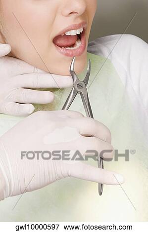 Dentist using pliers to pull out woman's teeth View Large Photo Image Stock Photo - Dentist using pliers to pull out woman's teeth. Fotosearch