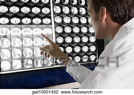 Doctor examining MRI report View Large Photo Image Stock Image - Doctor examining MRI report. Fotosearch