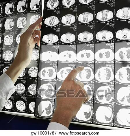 Stock Photo - Doctor examining MRI report. Fotosearch