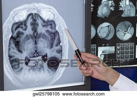 Doctor examining MRI report View Large Photo Image Stock Photography - Doctor examining MRI report. Fotosearch
