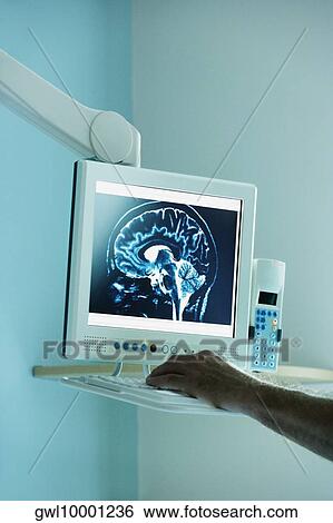 Doctor examining MRI scan on a computer screen View Large Photo Image Stock Photograph - Doctor examining MRI scan on a computer screen. Fotosearch