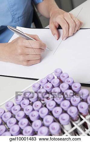 Female lab technician preparing a medical report View Large Photo Image Stock Image - Female lab technician preparing a medical report. Fotosearch