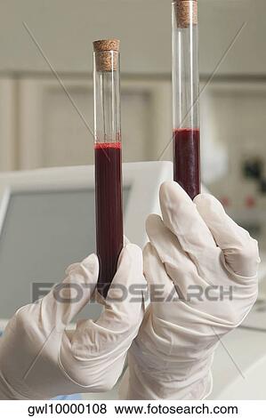 Lab technician holding blood samples in a test tube View Large Photo Image Stock Photo - Lab technician holding blood samples in a test tube. Fotosearch