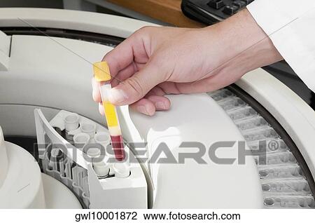 Lab technician putting a blood sample in the laboratory freezer View Large Photo Image Stock Image - Lab technician putting a blood sample in the laboratory freezer. Fotosearch