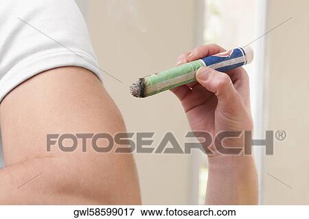 Man receiving moxibustion treatment View Large Photo Image Stock Photo - Man receiving moxibustion treatment. Fotosearch
