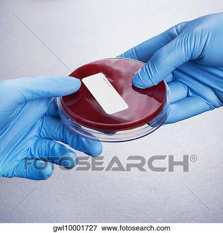 Petri dish in two doctors' hands View Large Photo Image Stock Photo - Petri dish in two doctors' hands. Fotosearch