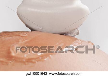Stock Image - Pregnant woman going through an ultrasound scan. Fotosearch