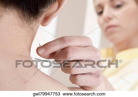 Acupuncturist applying needles on a person's back View Large Photo Image Stock Image - Acupuncturist applying needles on a person's back. Fotosearch