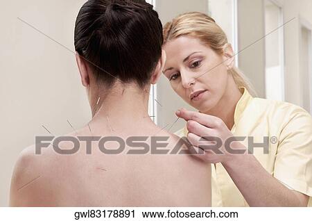 Acupuncturist applying needles on a woman's back View Large Photo Image Stock Image - Acupuncturist applying needles on a woman's back. Fotosearch