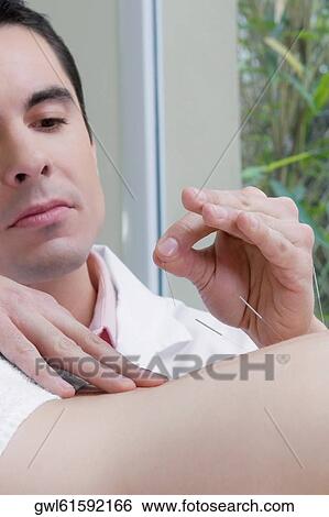 Stock Photograph - Acupuncturist applying needles on a person's back. Fotosearch