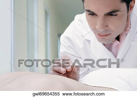 Acupuncturist applying needles on a person's back View Large Photo Image Stock Photography - Acupuncturist applying needles on a person's back. Fotosearch