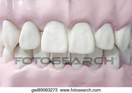 Close-up of a set of dentures View Large Photo Image Stock Image - Close-up of a set of dentures. Fotosearch