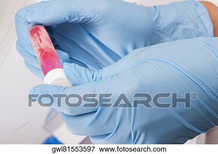 Doctor holding a medical sample in a laboratory View Large Photo Image Stock Photo - Doctor holding a medical sample in a laboratory. Fotosearch